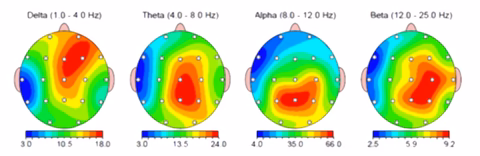 Brain Maps - EEG